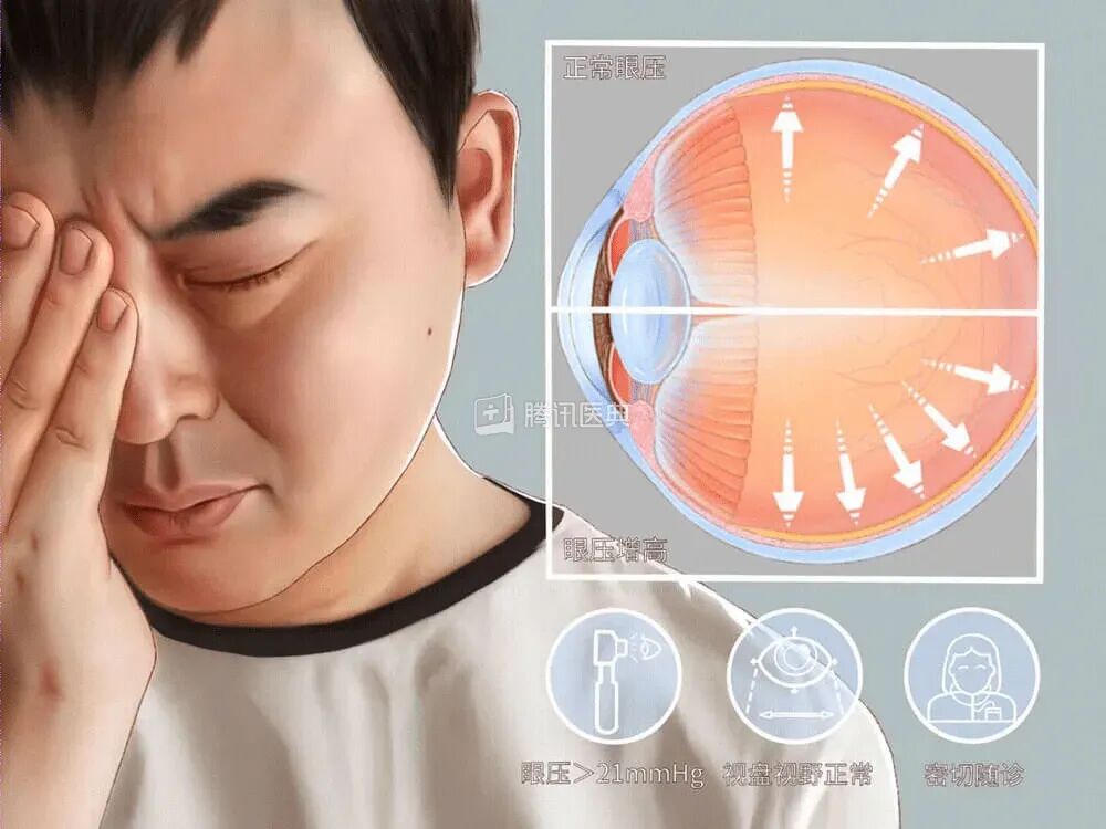 眼压升高 图片